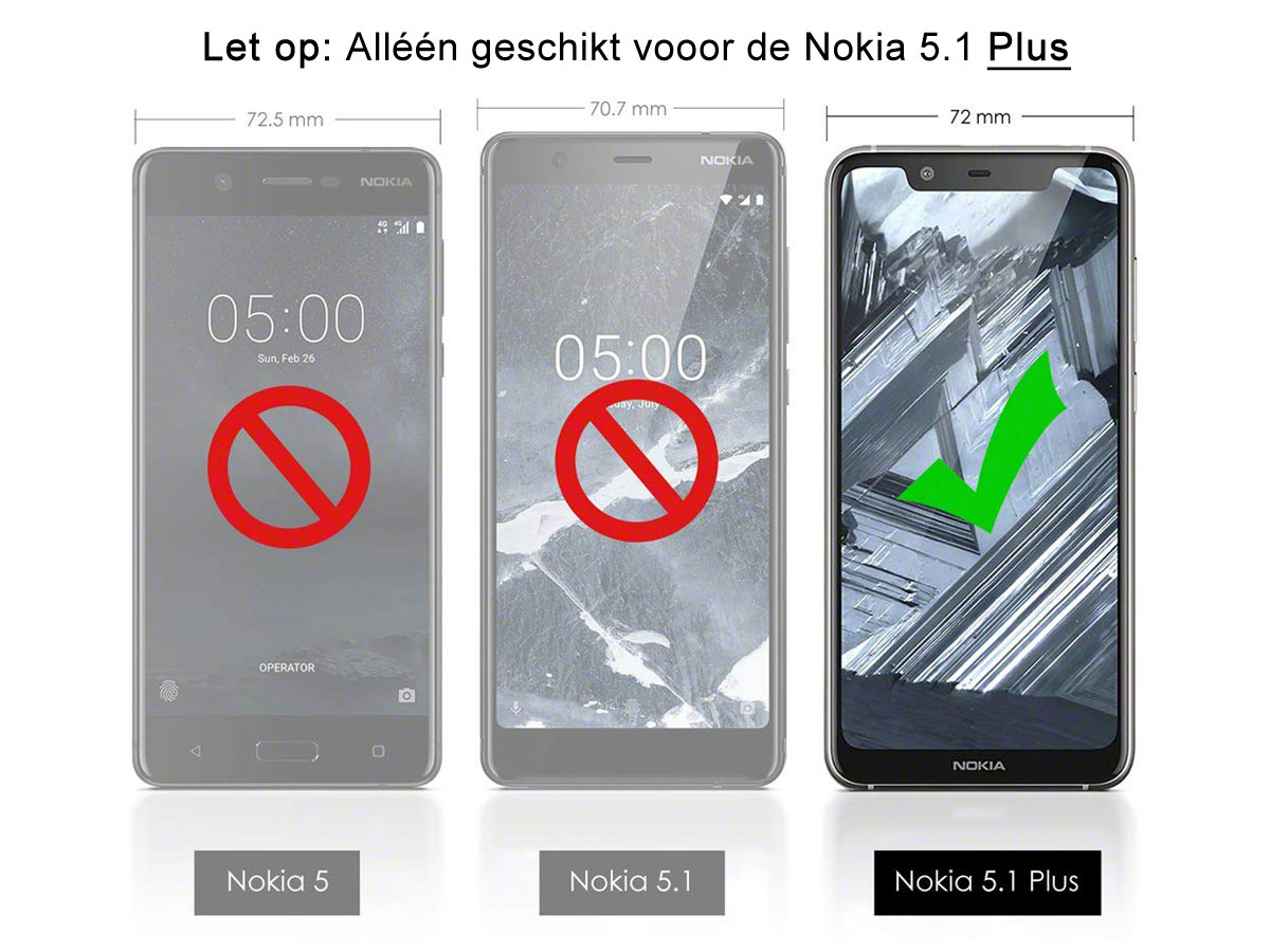 CaseBoutique Carbon TPU Skin - Nokia 5.1 Plus Hoesje